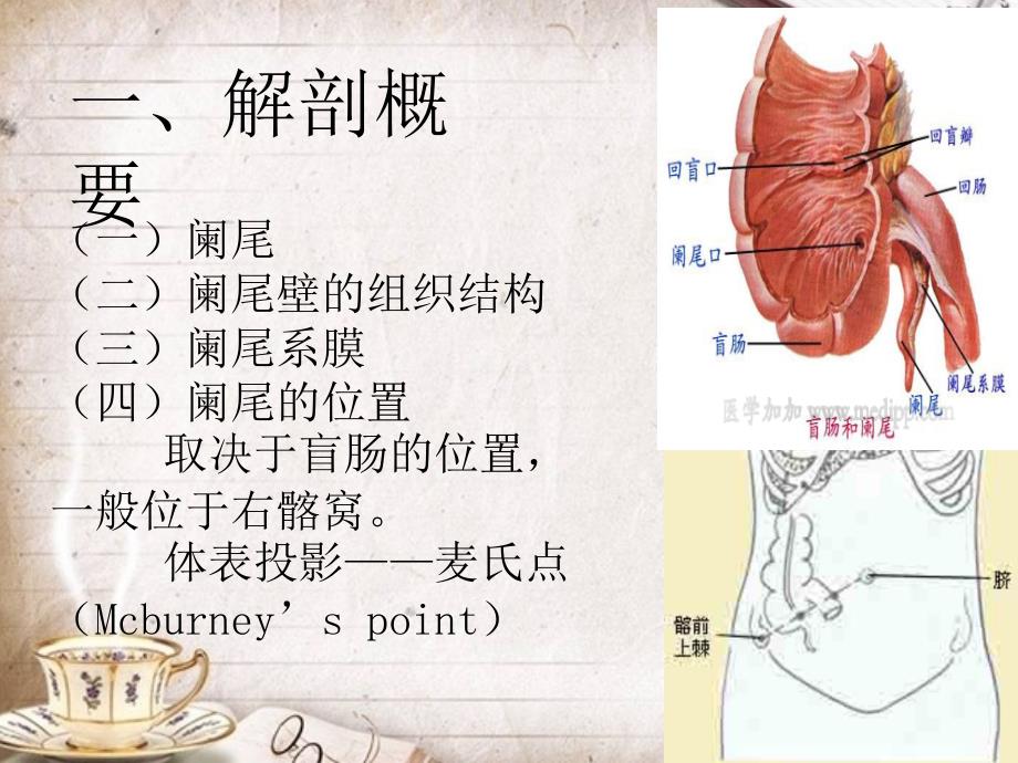 急性阑尾炎护理查房.ppt_第3页