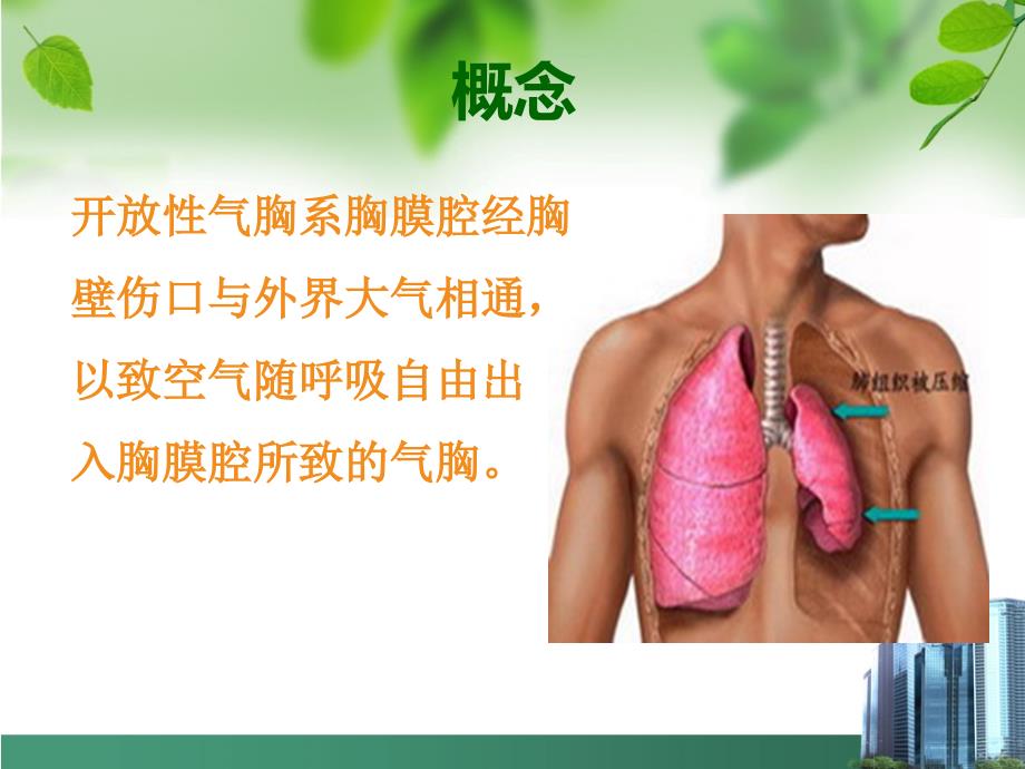 开放性气胸护理.ppt_第3页