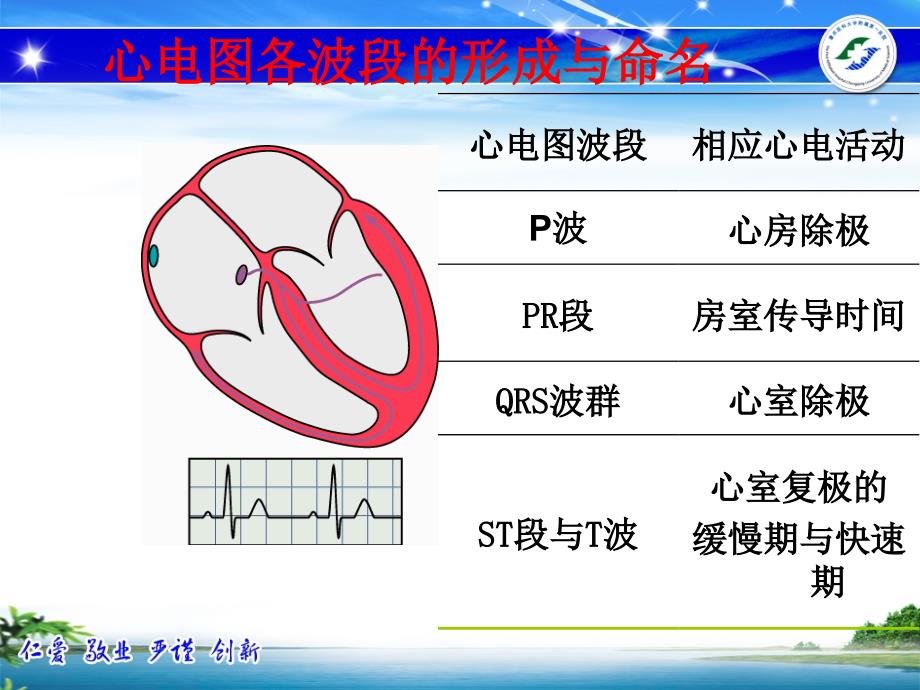 常见心电图危急值及处理.ppt_第3页