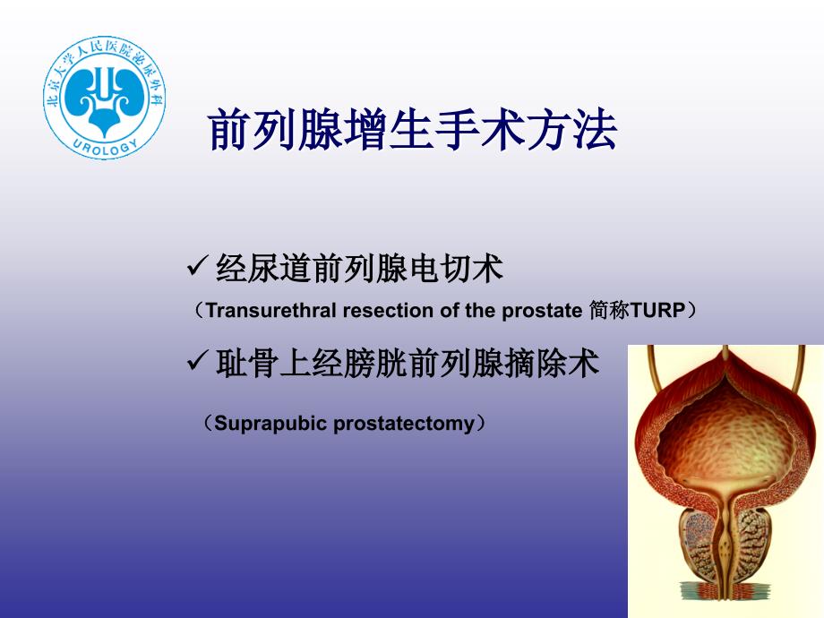 泌尿外科术后.ppt_第2页