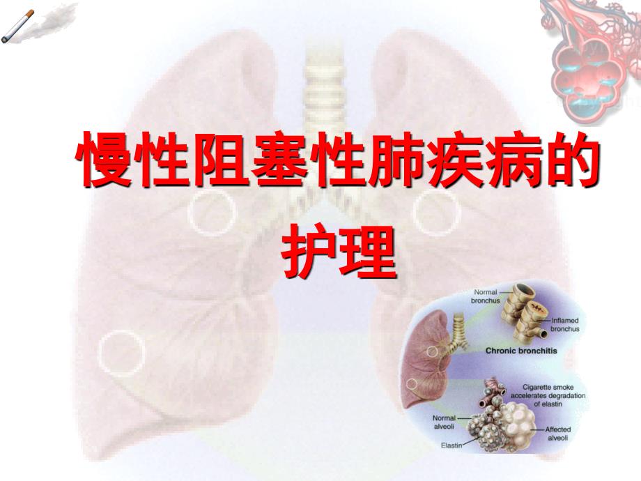 最新COPD的护理PPT.ppt_第1页