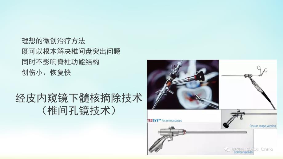 椎间孔镜技术PPT课件.ppt_第3页