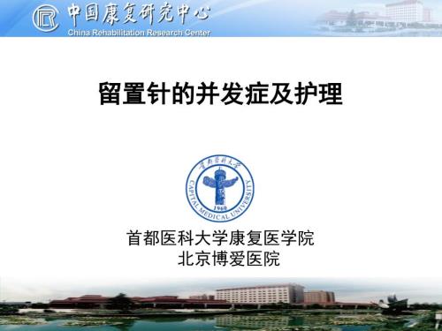 留置针的并发症及处理ppt课件.pptx