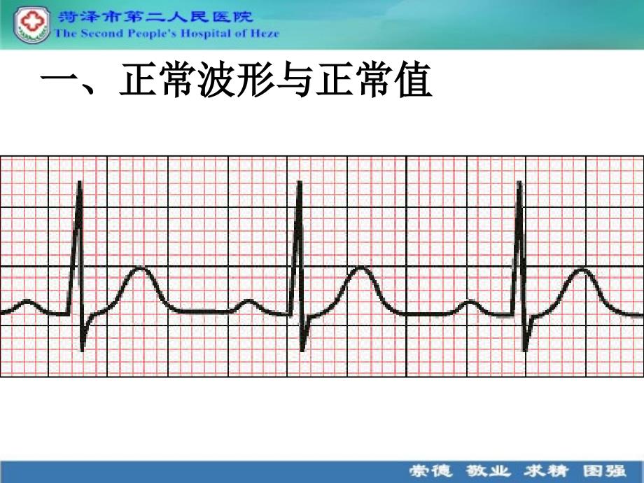 心电图解读.ppt_第3页