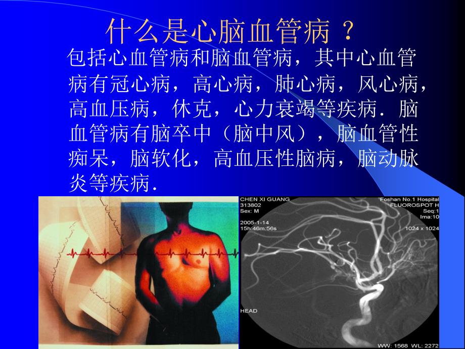 心脑血管病的危害PPT课件.ppt_第2页