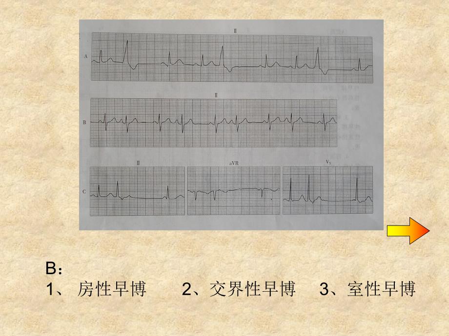 心电图学试题.ppt_第3页