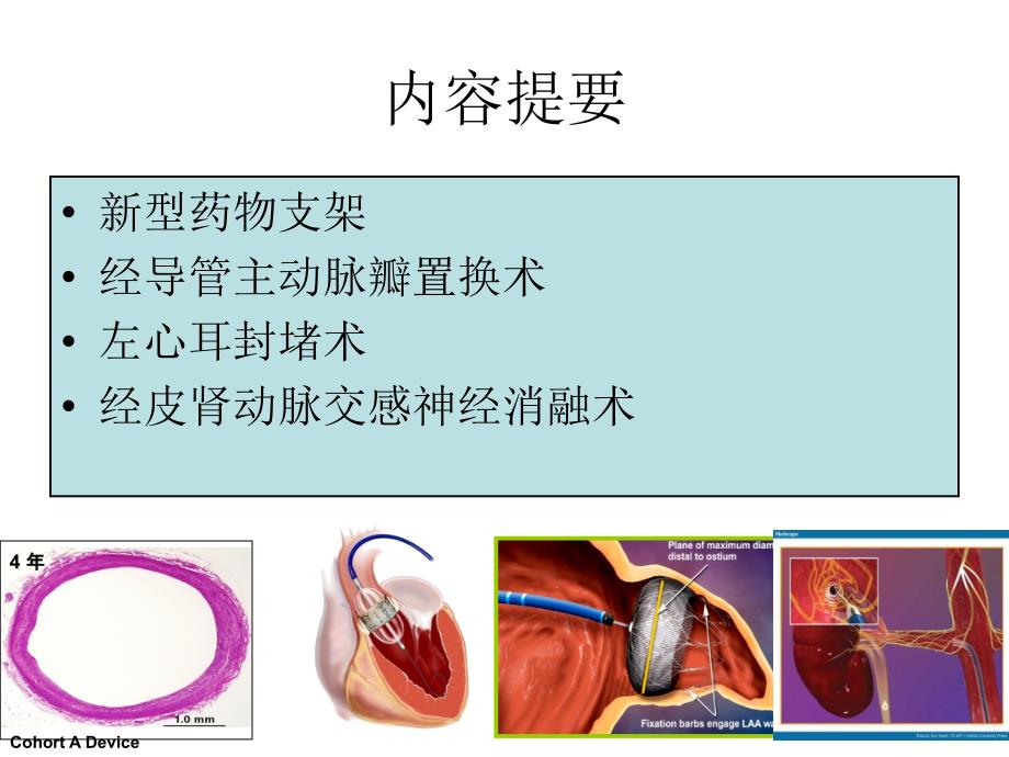 最新心血管介入治疗技术.ppt_第2页