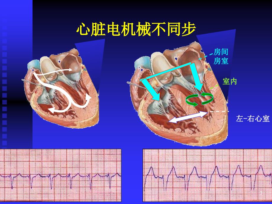 最新crt指南解读.ppt_第3页