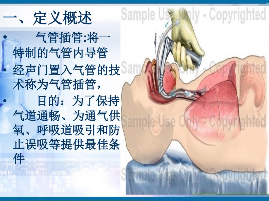 气管插管护理.ppt_第2页