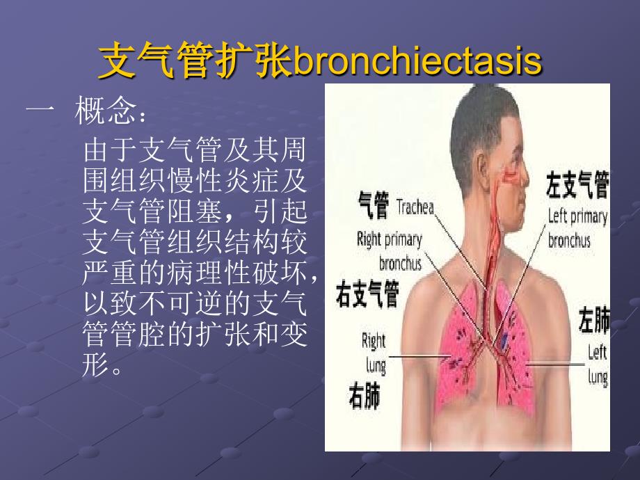 支气管扩张症护理查房.ppt_第2页