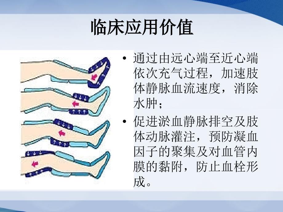 气压治疗仪的使用课件.ppt_第2页