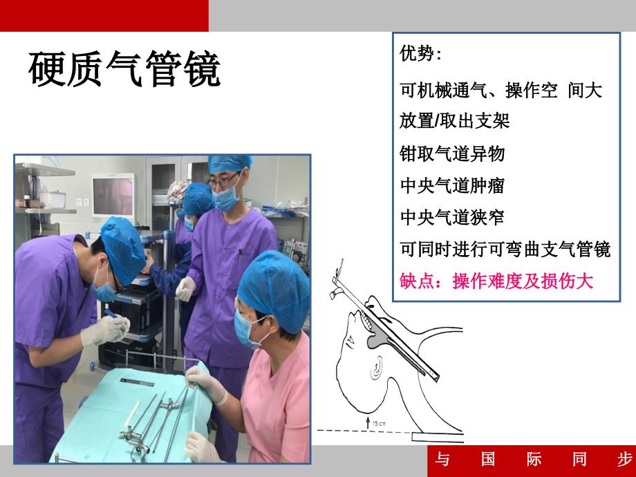 支气管镜培训PPT课件.ppt_第3页