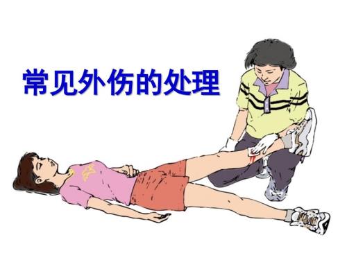 常见外伤的处理课件.ppt