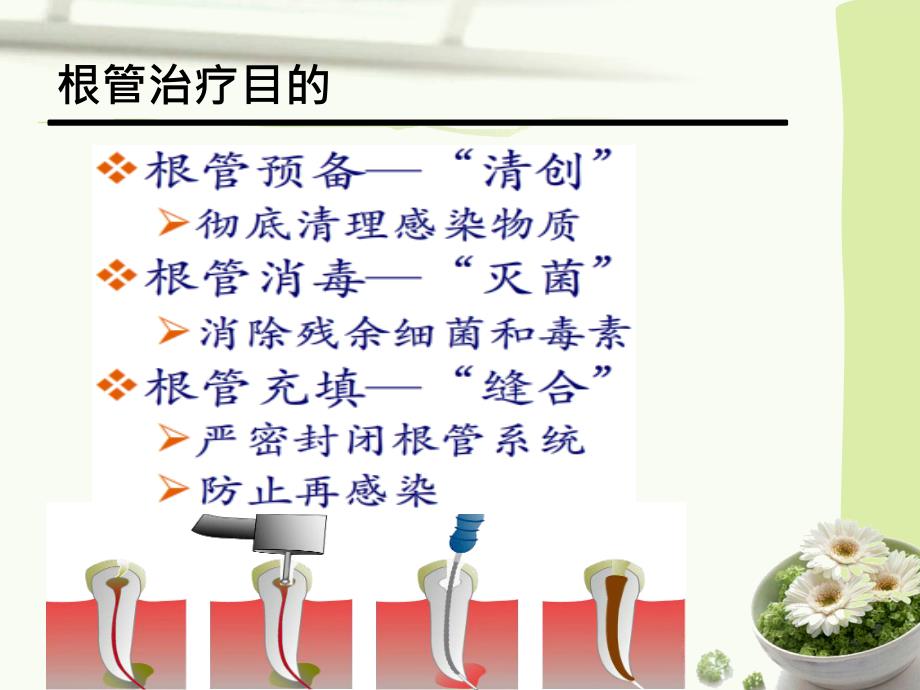 根管预备器械及方法总结.ppt_第2页