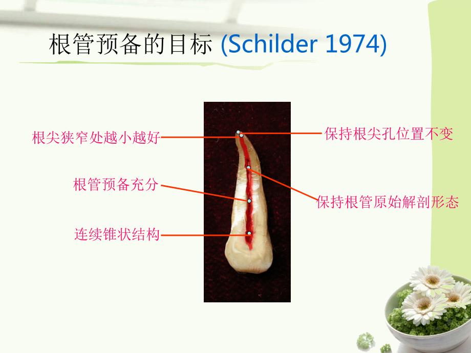 根管预备器械及方法总结.ppt_第3页