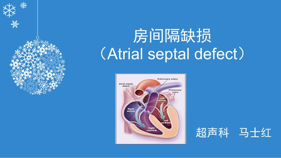 房间隔缺损PPT课件.ppt_第1页