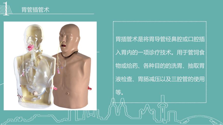 留置胃管的护理PPT课件.ppt_第3页