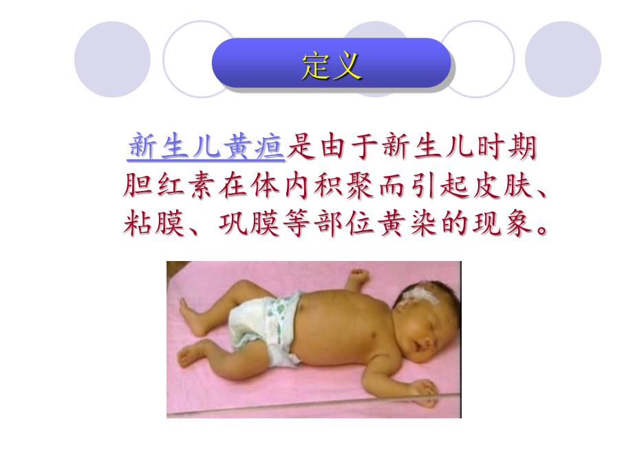 新生儿黄疸护理PPT课件.ppt_第2页