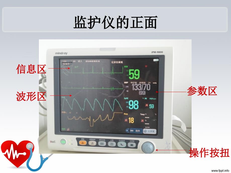 心电监护的使用PPT课件.ppt_第3页