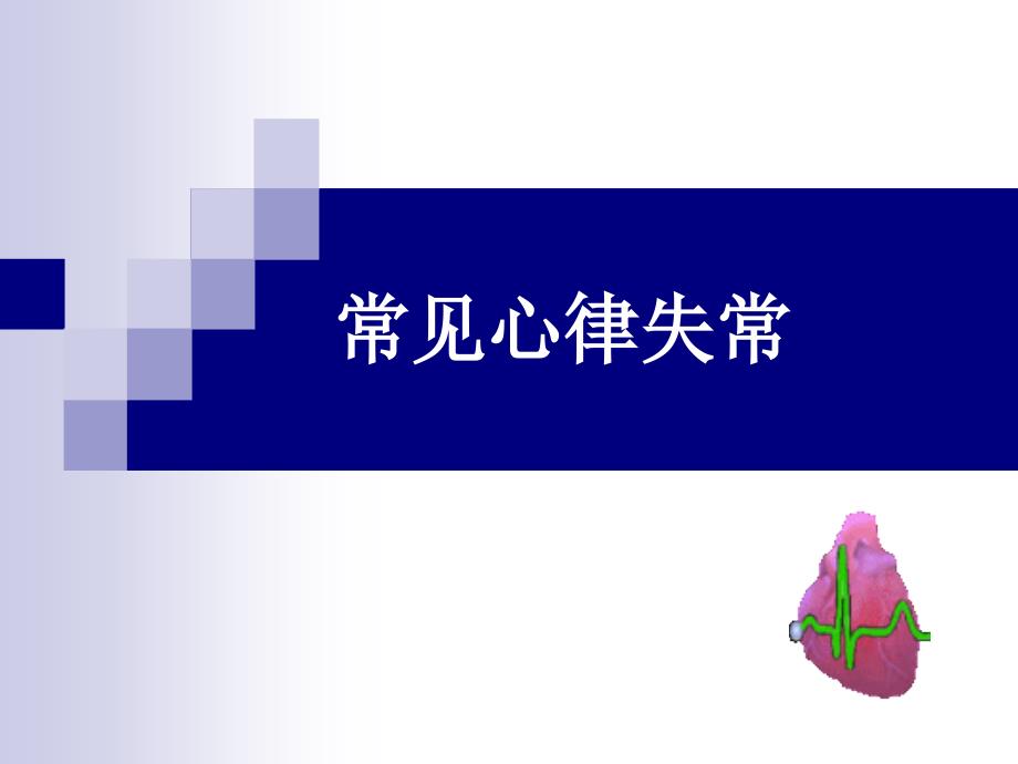 心律失常实验课用.ppt_第1页