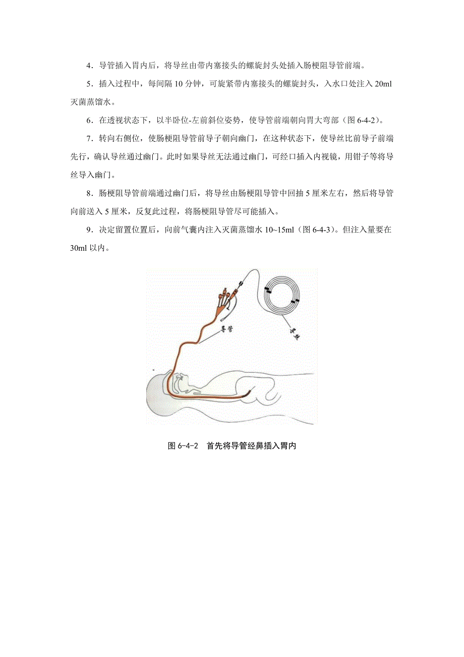 整理肠梗阻导管套件使用.doc_第3页