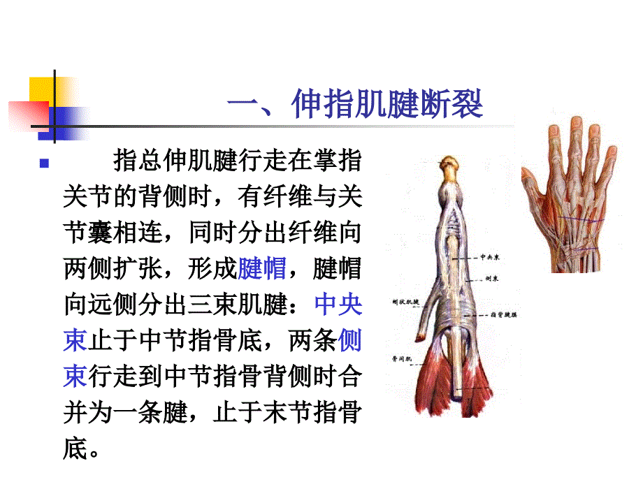 指伸屈肌腱断裂ppt课件.ppt_第2页