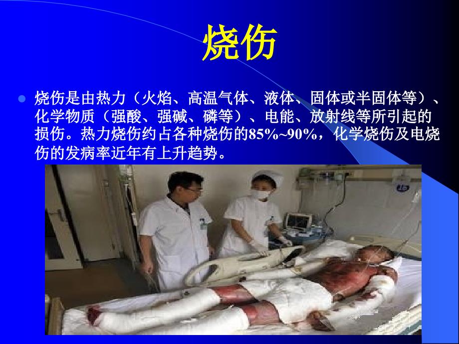 烧伤的现场急救PPT课件.ppt_第2页