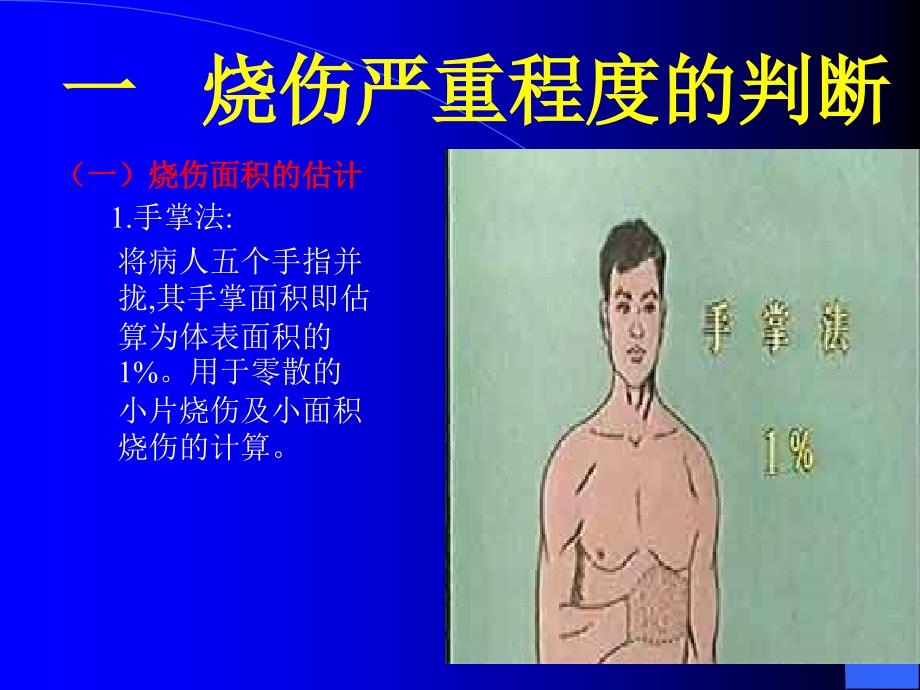 烧伤的现场急救PPT课件.ppt_第3页