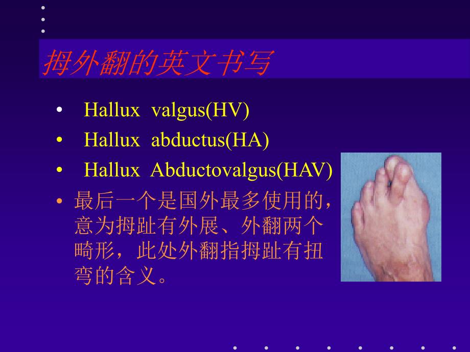 拇外翻分型及治疗课件.ppt_第2页
