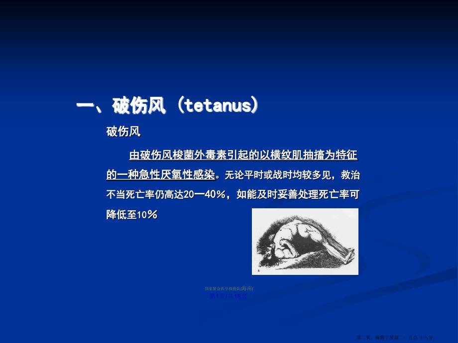 破伤风新学习教案.pptx_第2页