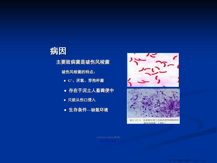 破伤风新学习教案.pptx_第3页