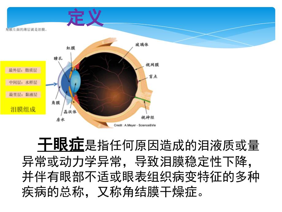 干眼症的预防与护理.ppt_第3页