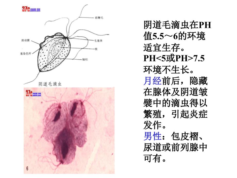 滴虫性阴道炎PPT课件.ppt_第3页
