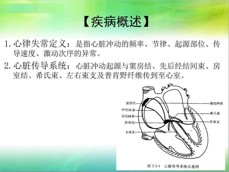 心律失常病人的护理查房.ppt_第2页