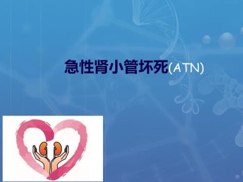 急性肾小管坏死.ppt