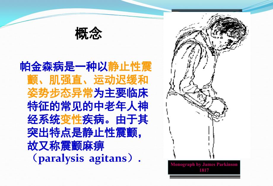帕金森病的护理.ppt_第3页