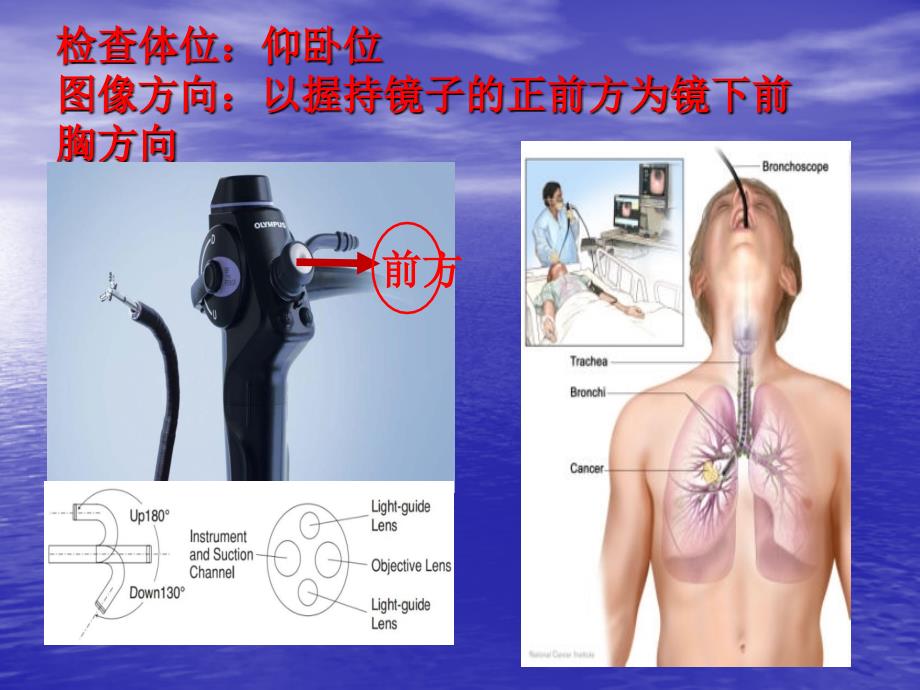 支气管分段亚段及及支气管镜检查.ppt_第2页
