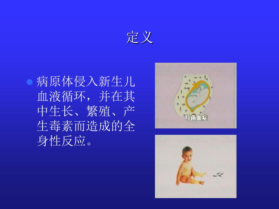 新生儿败血症PPT课件.ppt_第2页