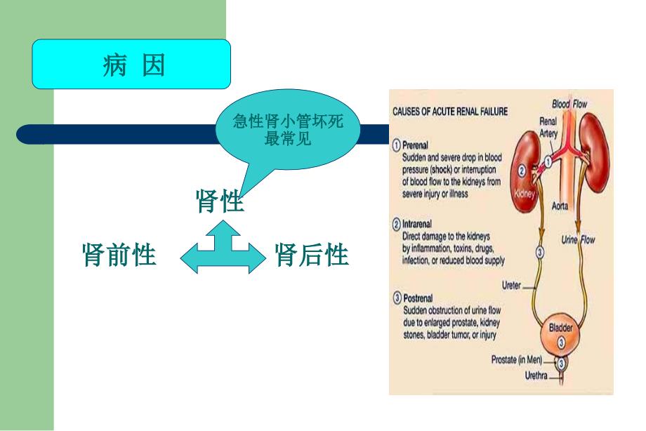 急性肾衰竭血液透析护理查房.ppt_第2页