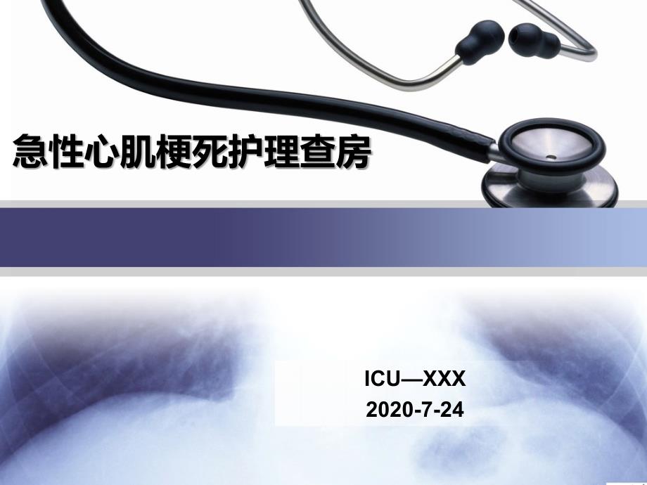 急性心肌梗死护理查房.ppt_第1页