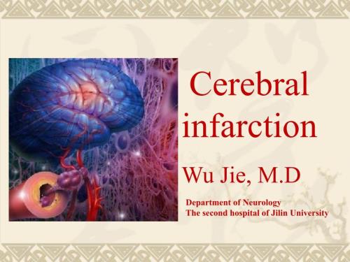 最经典的脑梗死临床表现及治疗.ppt