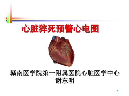心脏猝死预警心电图谢东明.ppt