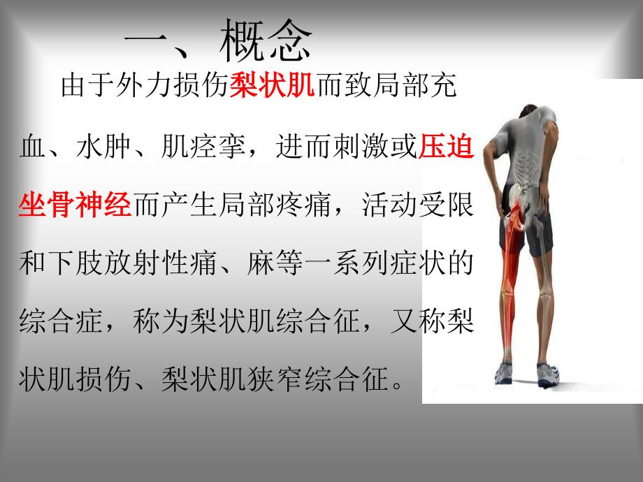 梨状肌综合征课件.ppt_第2页
