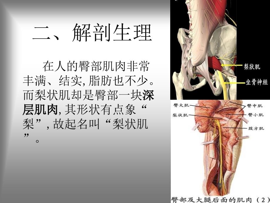 梨状肌综合征课件.ppt_第3页