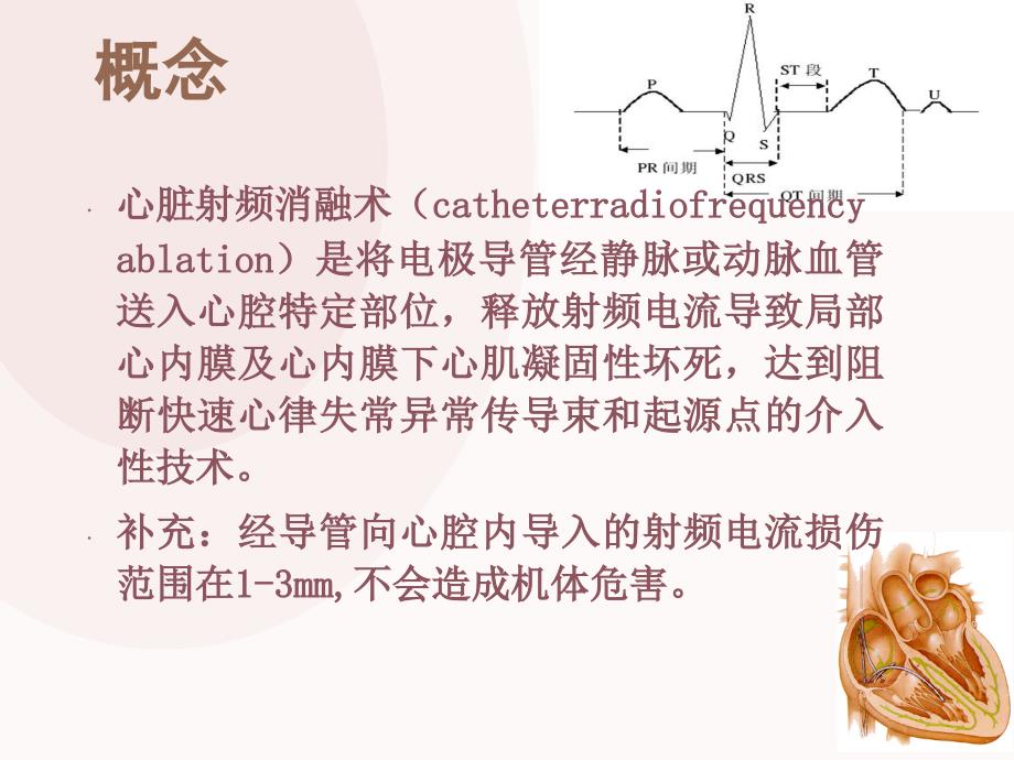 心脏射频消融术的护理.ppt_第2页