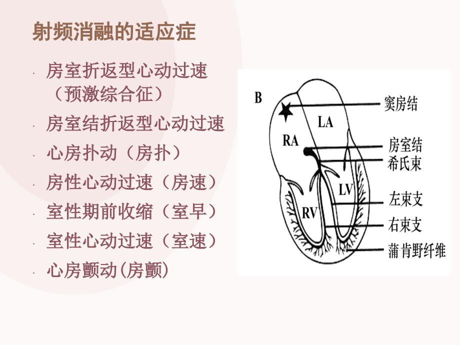 心脏射频消融术的护理.ppt_第3页