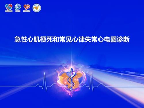 急性心肌梗死和常见心律失常心电图诊断核心科室培训.ppt