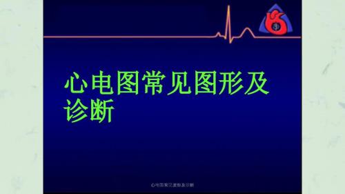 心电图常见波形及诊断课件.ppt