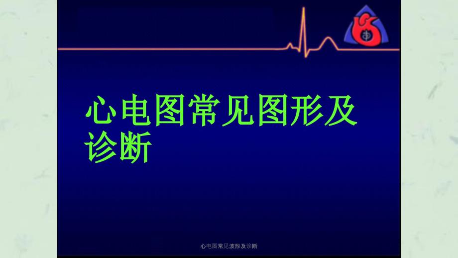 心电图常见波形及诊断课件.ppt_第1页