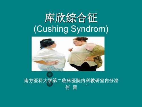 库欣综合征.ppt